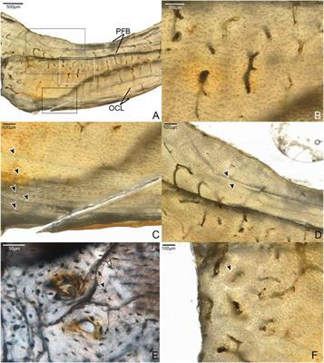 Intraskeletal Osteohistovariability Reveals Complex Growth Strategies in a Late Cretaceous Enantiornithine
